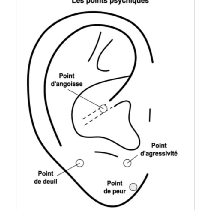 Cartographie des points de l’oreille : points psychiques