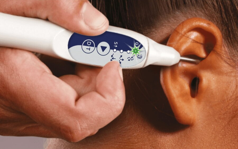 Réflexologie auriculaire au PREMIO-40, sans aiguille